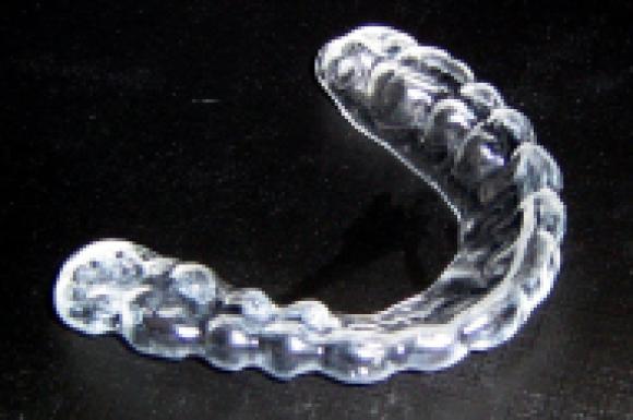 Ortodontia: Placa Oclusal usada para Bruxismo